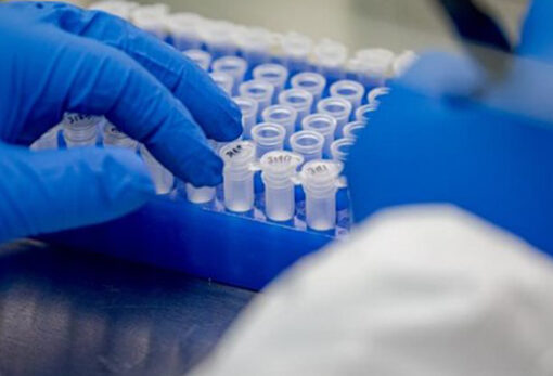 PRESIDENTI VUÇIQ KA PARALAJMRUAR TESTIME MASSIVE NË VIRUSIN KORONA, SPITALI USHTARAK I NISHIT PËR PACIENTËT E RËNDË