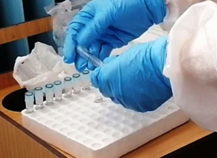 СТИЖЕ 30.000 ТЕСТОВА НА КОРОНА ВИРУС ЗА ЦЕО ЈУГ СРБИЈЕ