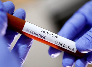 75 CORONAVIRUS CASES IN PCINJ DISTRICT, 3 MUNICIPALITIES WITHOUT ANY INFECTED PERSONS