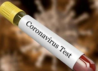 18 NEW CORONA VIRUS CASES IN PCINJ DISTRICT, ONE FROM BUJANOVAC