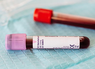 THERE ARE 30 NEWLY INFECTED PEOPLE IN THE JABLANICA DISTRICT