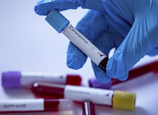 THE NUMBER OF CORONAVIRUS PATIENTS IN THE PCINJ DISTRICT IS STAGNATING