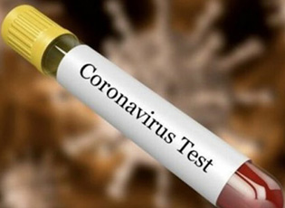 THREE MORE PERSONS FROM BUJANOVAC POSITIVE FOR THE CORONAVIRUS