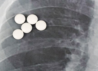 THE NUMBER OF PATIENTS WITH PNEUMONIA IS GROWING